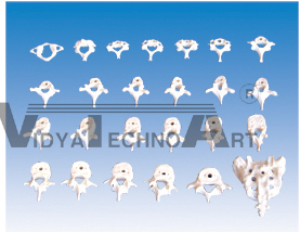 The model of cervical,sternal lumbar vertebrae and sacral bone(26pcs) Dimension:Natural size